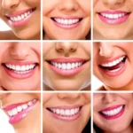 Conoce los secretos detrás de las sonrisas deslumbrantes de las celebridades y aprende cómo lograr un blanqueamiento dental efectivo